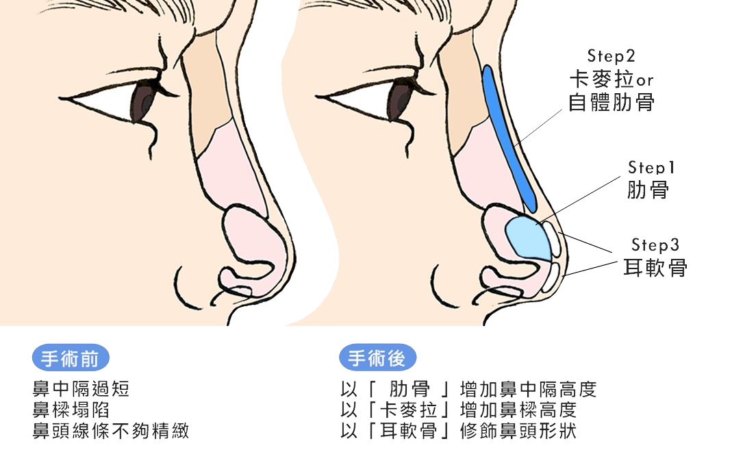 Group_69-ai-brush-removebg-au8dp908