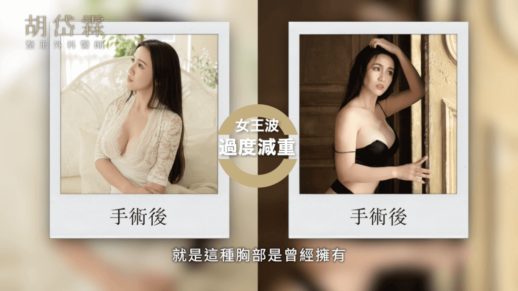 女王波,過度減重,胡岱霖醫師