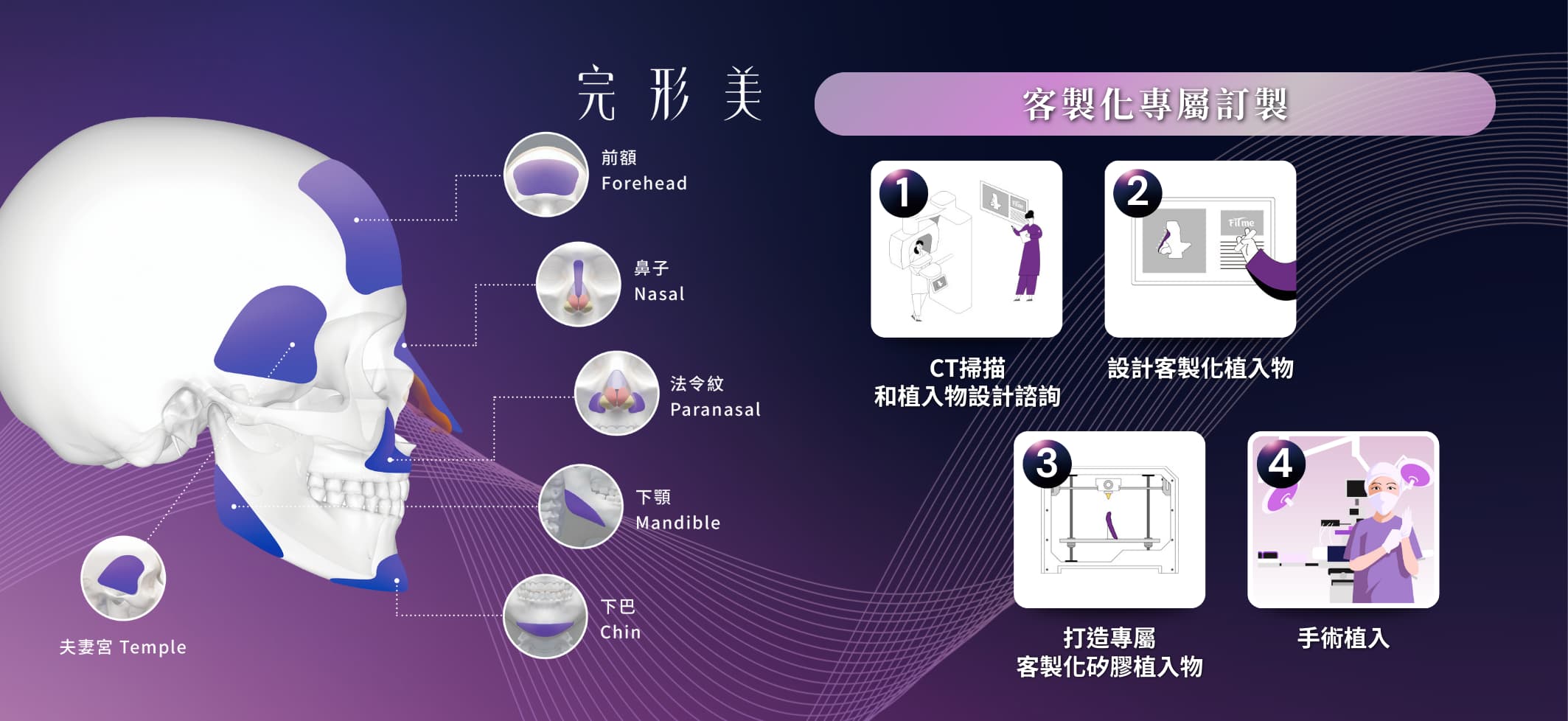 FiTme完形美3D列印植體步驟與應用