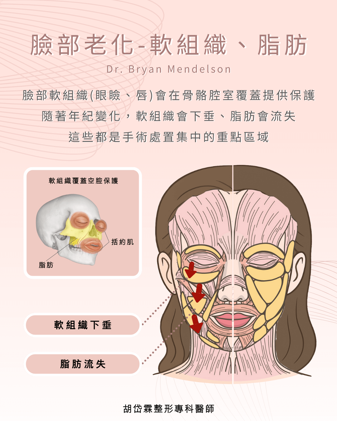 臉部老化,軟組織,脂肪,拉皮