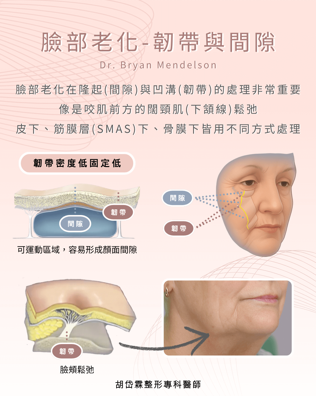 臉部老化-韌帶與間隙